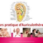 Module Auriculothérapie